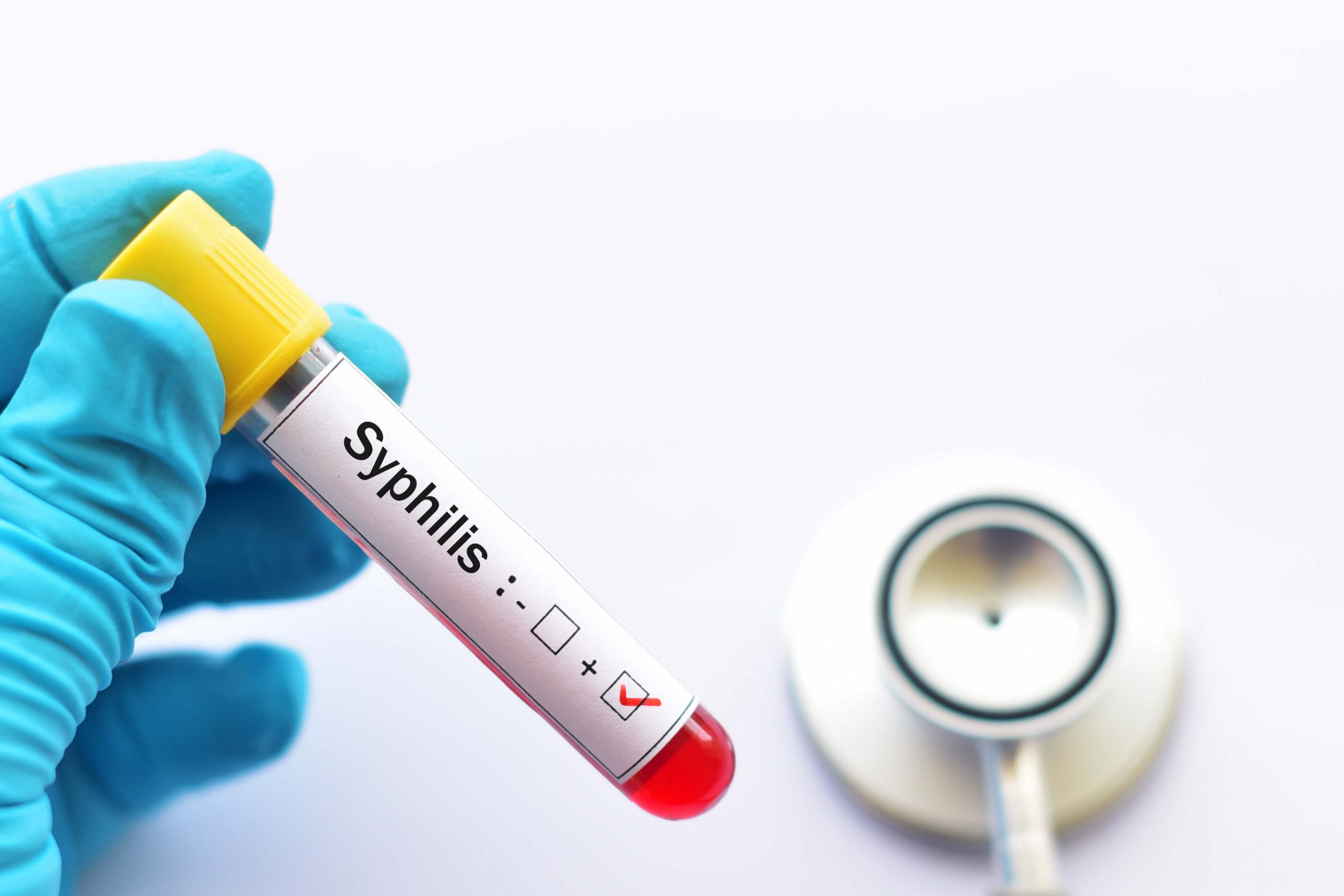 Test syphilis sans ordonnance